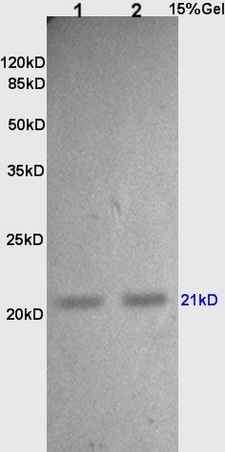 L1 and L2 rat lung lysates probed with Anti TIMP-2 Polyclonal Antibody, Unconjugated (bs-0416R) at 1:200 in 4˚C. Followed by conjugation to secondary antibody (bs-0295G-HRP) at 1:3000 90min in 37˚C. Predicted band 24kD. Observed band size: 21kD