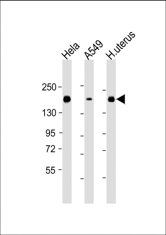 Lane 1: Hela cell lysates; Lane 2: A549 cell lysates; Lane 3: Human uterus lysates probed with ITGA11 Monoclonal Antibody, Unconjugated (bsm-51661M) at 1:2000 dilution and 4˚C overnight incubation. Followed by conjugated secondary antibody incubation at 1:20000 for 60 min at 37˚C.