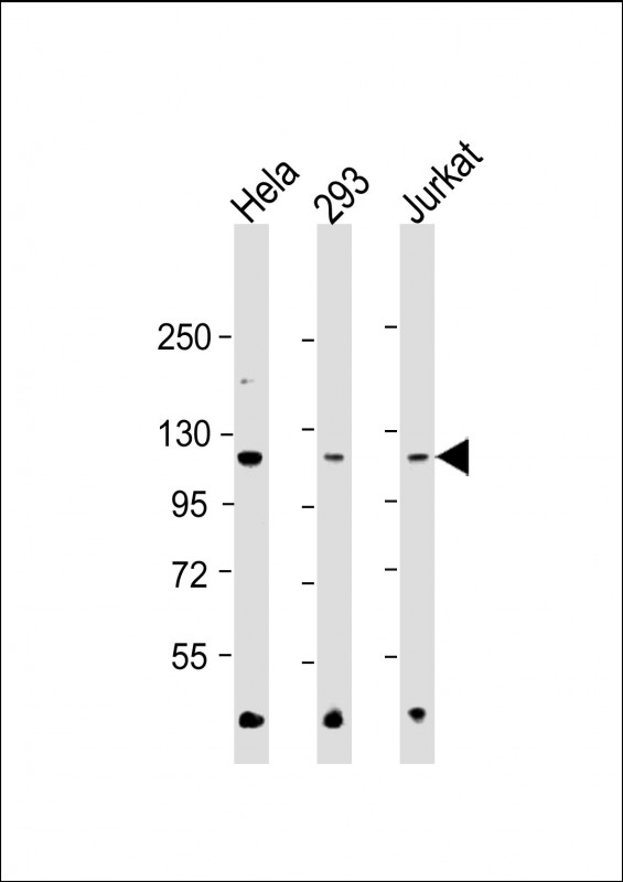 Lane 1: Hela cell lysates; Lane 2: 293 cell lysates; Lane 3: Jurkat cell lysates probed with Hexokinase II Monoclonal Antibody, Unconjugated (bsm-51659M) at 1:500 dilution and 4°C overnight incubation. Followed by conjugated secondary antibody incubation at 1:20000 for 60 min at 37°C.