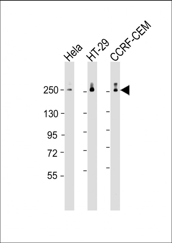 Lane 1: Hela cell lysates; Lane 2: HT-29 cell lysates; Lane 3: CCRF-CEM cell lysates probed with RNA polymerase II / POLR2A Monoclonal Antibody, Unconjugated (bsm-51657M) at 1:2000 dilution and 4˚C overnight incubation. Followed by conjugated secondary antibody incubation at 1:20000 for 60 min at 37˚C.