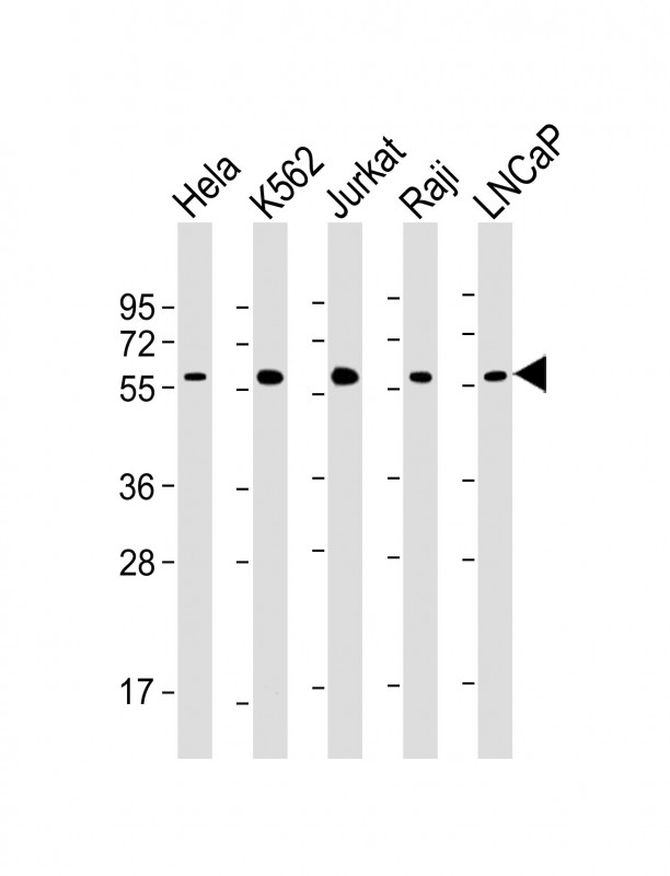Lane 1: Hela cell lysates; Lane 2: K562 cell lysates; Lane 3: Jurkat cell lysates; Lane 4: Raji cell lysates; Lane 5: LNCaP cell lysates probed with c-MYC Monoclonal Antibody, Unconjugated (bsm-51652M) at 1:2000 dilution and 4˚C overnight incubation. Followed by conjugated secondary antibody incubation at 1:20000 for 60 min at 37˚C.