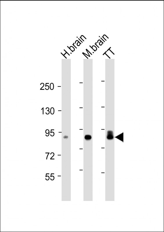 Lane 1: Human Brain lysates; Lane 2: Mouse Brain lysates; Lane 3: TT cell lysates probed with DCAMKL1 Monoclonal Antibody, Unconjugated (bsm-51643M) at 1:4000 dilution and 4˚C overnight incubation. Followed by conjugated secondary antibody incubation at 1:20000 for 60 min at 37˚C.