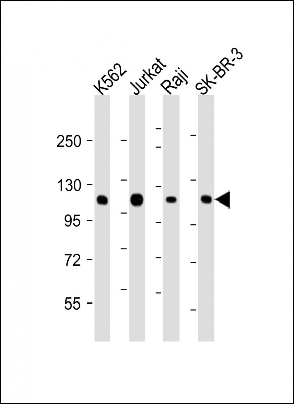 Lane 1: K562 cell lysates; Lane 2: Jurkat cell lysates; Lane 3: Raji cell lysates; Lane 4: SK-BR-3 cell lysates probed with CBL Monoclonal Antibody, Unconjugated (bsm-51640M) at 1:2000 dilution and 4˚C overnight incubation. Followed by conjugated secondary antibody incubation at 1:20000 for 60 min at 37˚C.