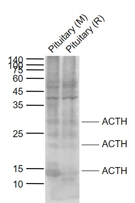 Lane 1: Mouse Pituitary tissue lysates; Lane 2: Rat Pituitary tissue lysates probed with ACTH (7-23) Polyclonal Antibody, Unconjugated (bs-0004R) at 1:1000 dilution and 4\u00b0C overnight incubation. Followed by conjugated secondary antibody incubation at 1:20000 for 60 min at 37˚C.
