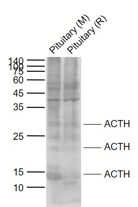 Lane 1: Mouse Pituitary tissue lysates; Lane 2: Rat Pituitary tissue lysates probed with ACTH (7-23) Polyclonal Antibody, Unconjugated (bs-0004R) at 1:1000 dilution and 4°C overnight incubation. Followed by conjugated secondary antibody incubation at 1:20000 for 60 min at 37°C.