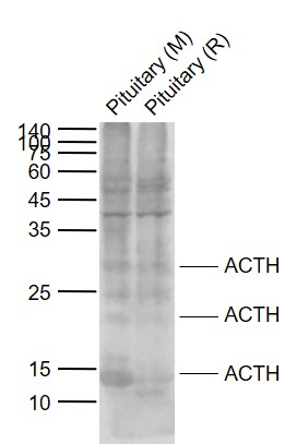 Lane 1: Mouse Pituitary tissue lysates; Lane 2: Rat Pituitary tissue lysates probed with ACTH (7-23) Polyclonal Antibody, Unconjugated (bs-0004R) at 1:1000 dilution and 4°C overnight incubation. Followed by conjugated secondary antibody incubation at 1:20000 for 60 min at 37˚C.