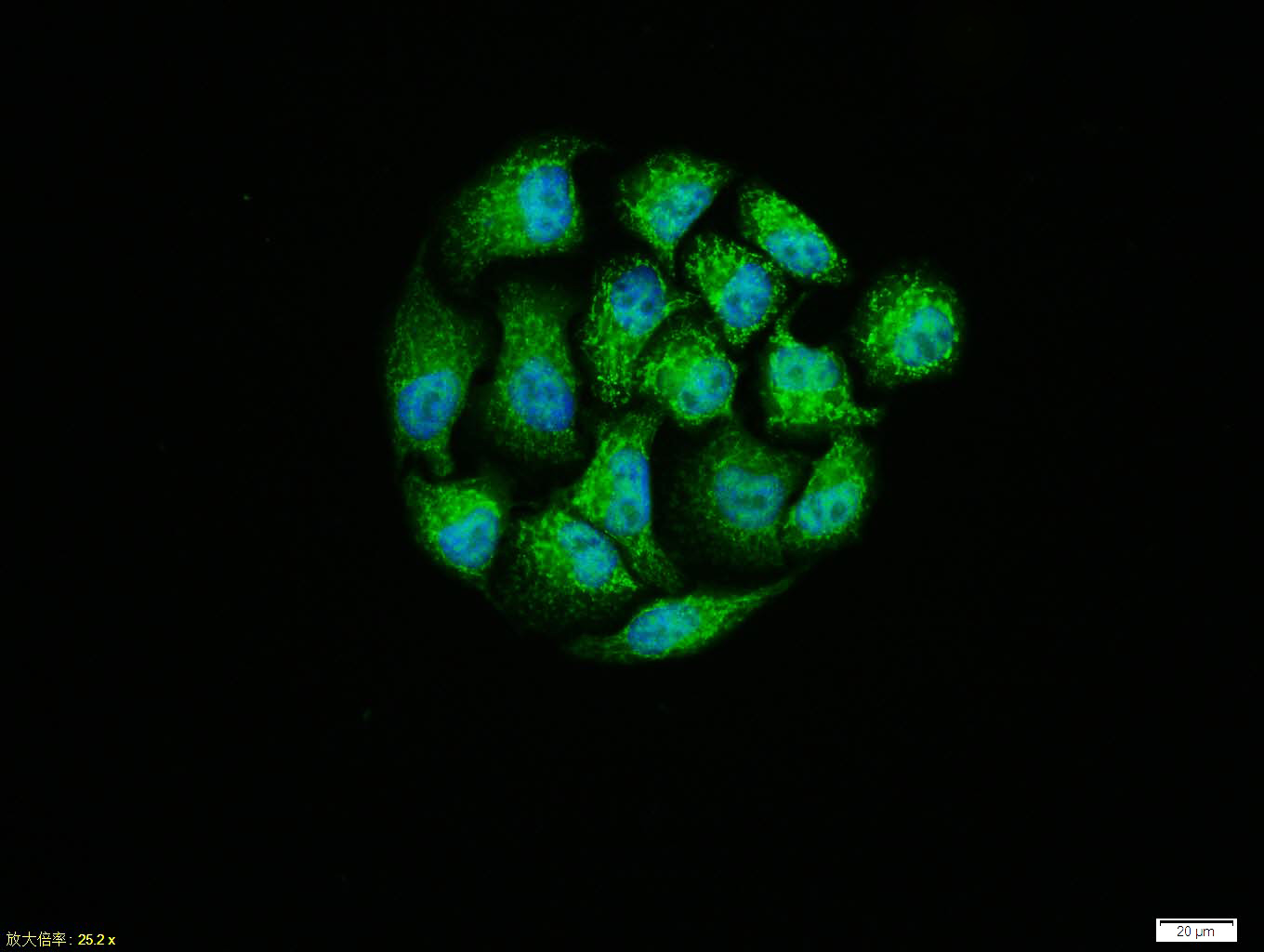 Hela cell; 4% Paraformaldehyde-fixed; Triton X-100 at room temperature for 20 min; Blocking buffer (normal goat serum, C-0005) at 37°C for 20 min; Antibody incubation with (MTNR1B) polyclonal Antibody, Unconjugated (bs-0963R) 1:100, 90 minutes at 37°C; followed by a conjugated Goat Anti-Rabbit IgG antibody at 37°C for 90 minutes, DAPI (blue, C02-04002) was used to stain the cell nuclei.