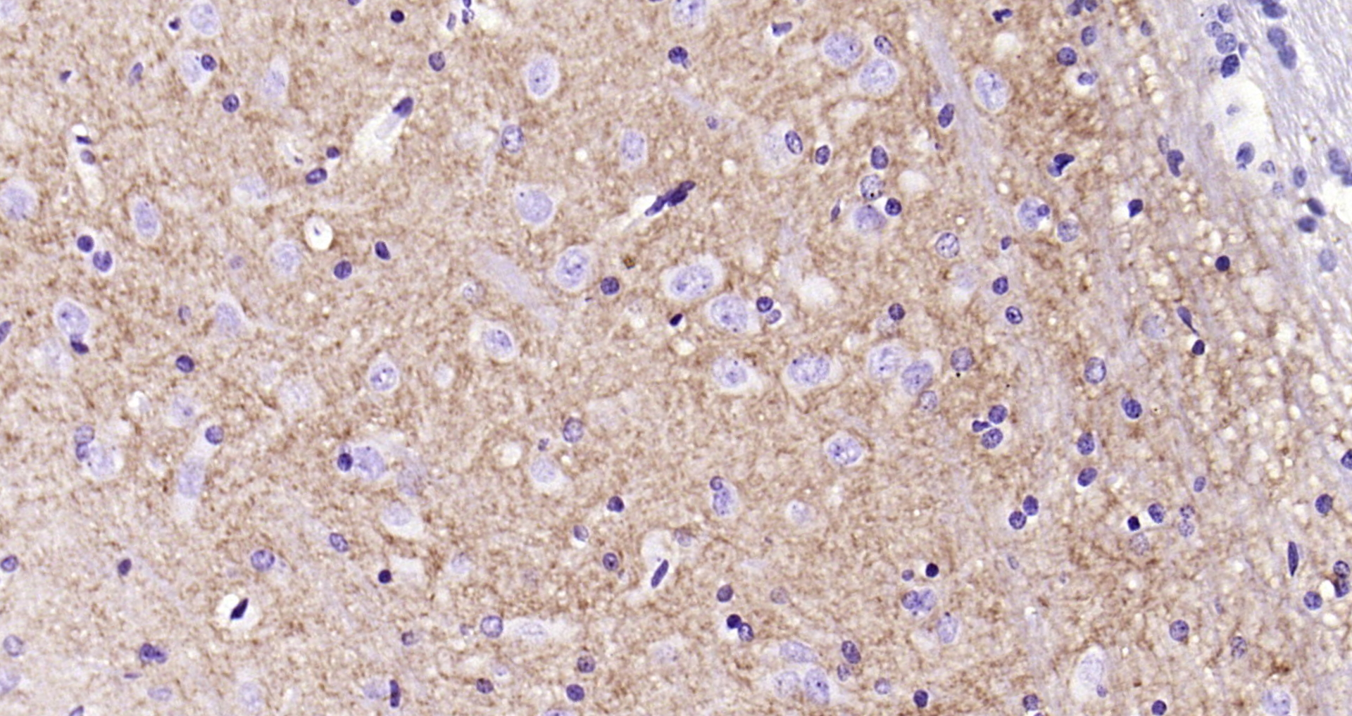 Paraformaldehyde-fixed, paraffin embedded Rat brain; Antigen retrieval by boiling in sodium citrate buffer (pH6.0) for 15min; Block endogenous peroxidase by 3% hydrogen peroxide for 20 minutes; Blocking buffer (normal goat serum) at 37°C for 30min; Antibody incubation with H Cadherin Monoclonal Antibody, Unconjugated (bsm-54321R) at 1:200 overnight at 4°C, DAB staining.