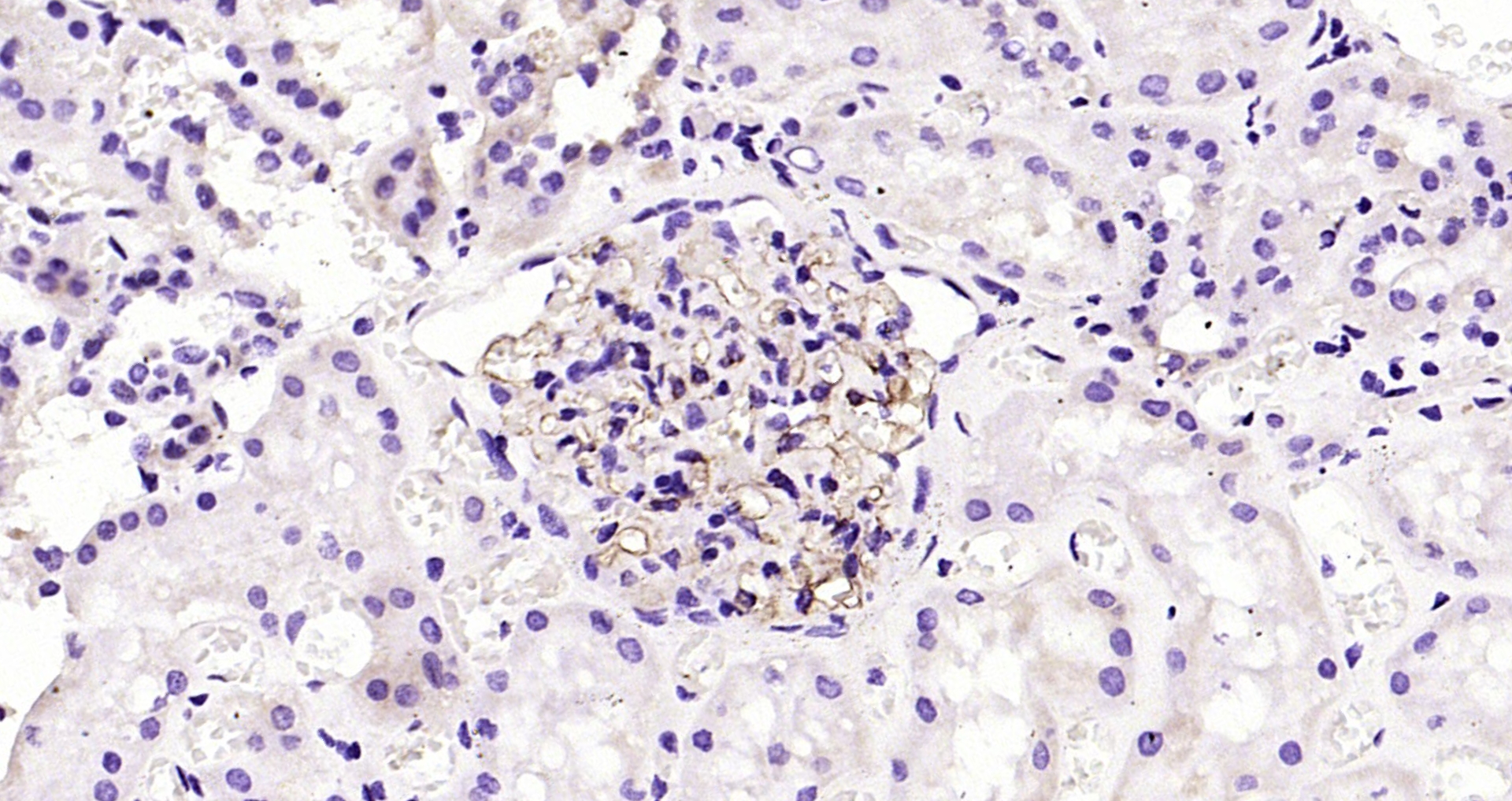 Paraformaldehyde-fixed, paraffin embedded Human kidney; Antigen retrieval by boiling in sodium citrate buffer (pH6.0) for 15min; Block endogenous peroxidase by 3% hydrogen peroxide for 20 minutes; Blocking buffer (normal goat serum) at 37°C for 30min; Antibody incubation with H Cadherin Monoclonal Antibody, Unconjugated (bsm-54321R) at 1:200 overnight at 4°C, DAB staining.