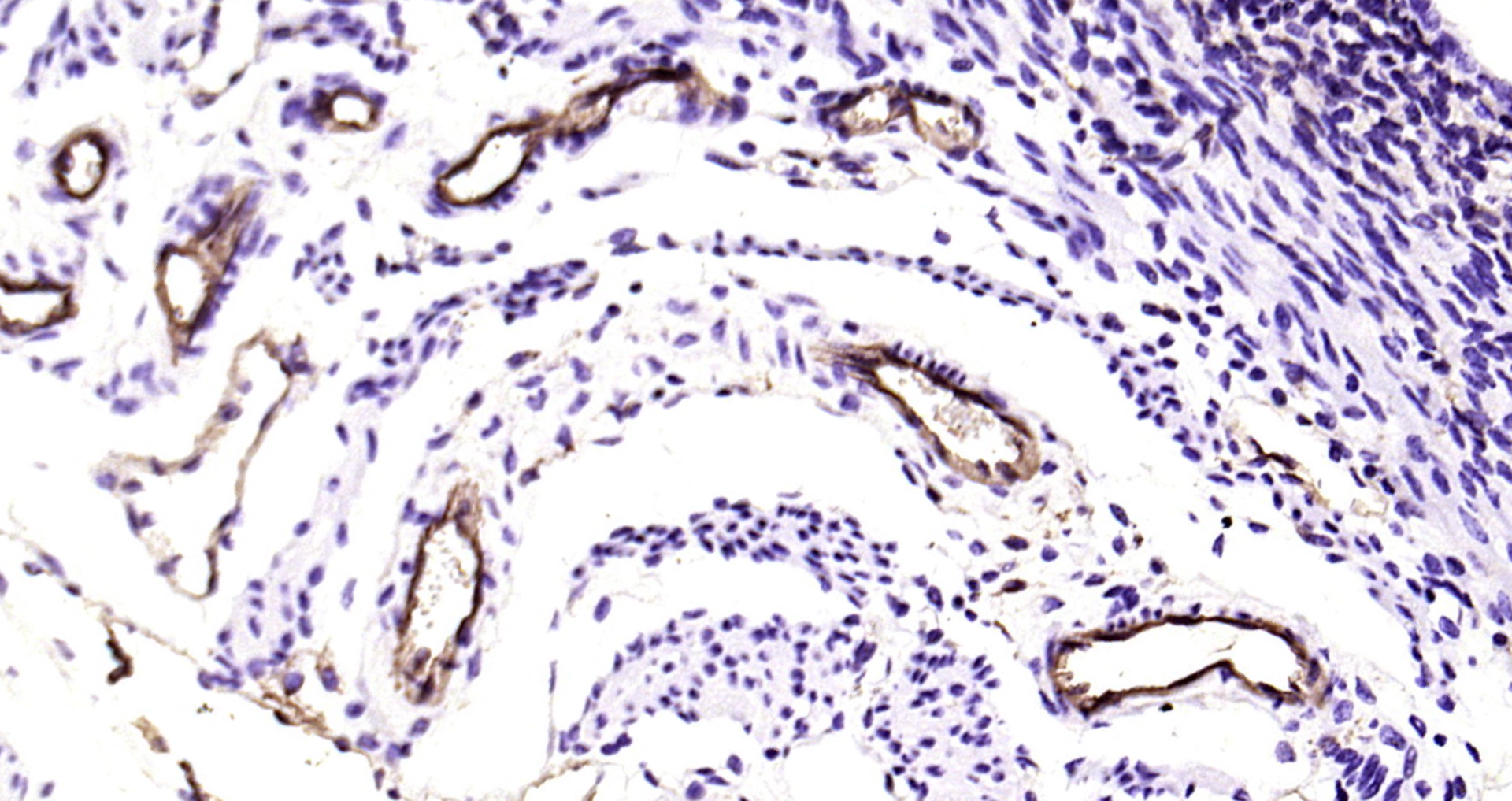 Paraformaldehyde-fixed, paraffin embedded Mouse uterus; Antigen retrieval by boiling in sodium citrate buffer (pH6.0) for 15min; Block endogenous peroxidase by 3% hydrogen peroxide for 20 minutes; Blocking buffer (normal goat serum) at 37°C for 30min; Antibody incubation with H Cadherin Monoclonal Antibody, Unconjugated (bsm-54321R) at 1:200 overnight at 4°C, DAB staining.