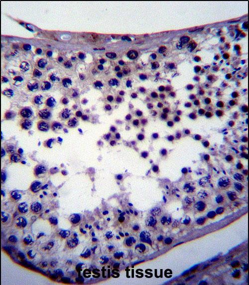 Paraformaldehyde-fixed, paraffin embedded Human testis; Antigen retrieval by boiling in sodium citrate buffer (pH6.0) for 15min; Block endogenous peroxidase by 3% hydrogen peroxide for 20 minutes; Blocking buffer (normal goat serum) at 37°C for 30min; Antibody incubation with NANOG Monoclonal Antibody, Unconjugated (bsm-51459M) at 1:200 overnight at 4°C, DAB staining.