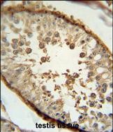 Paraformaldehyde-fixed, paraffin embedded Human testis; Antigen retrieval by boiling in sodium citrate buffer (pH6.0) for 15min; Block endogenous peroxidase by 3% hydrogen peroxide for 20 minutes; Blocking buffer (normal goat serum) at 37°C for 30min; Antibody incubation with NUP54 Monoclonal Antibody, Unconjugated (bsm-51465M) at 1:200 overnight at 4°C, DAB staining.