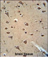 Paraformaldehyde-fixed, paraffin embedded Human brain; Antigen retrieval by boiling in sodium citrate buffer (pH6.0) for 15min; Block endogenous peroxidase by 3% hydrogen peroxide for 20 minutes; Blocking buffer (normal goat serum) at 37°C for 30min; Antibody incubation with ALDH2 Monoclonal Antibody, Unconjugated (bsm-51466M) at 1:200 overnight at 4°C, DAB staining.