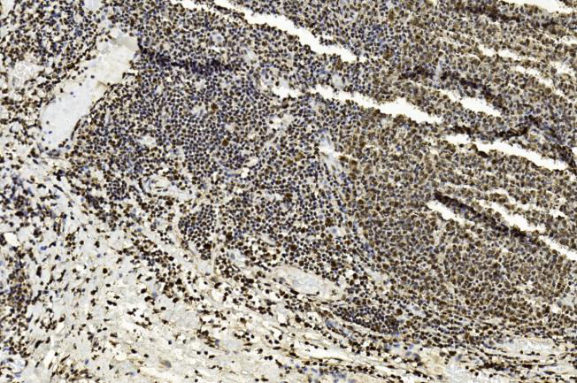 Paraformaldehyde-fixed, paraffin embedded Human tonsil; Antigen retrieval by boiling in sodium citrate buffer (pH6.0) for 15min; Block endogenous peroxidase by 3% hydrogen peroxide for 20 minutes; Blocking buffer (normal goat serum) at 37°C for 30min; Antibody incubation with EZH2 Monoclonal Antibody, Unconjugated (bsm-51468M) at 1:50 overnight at 4°C, DAB staining.