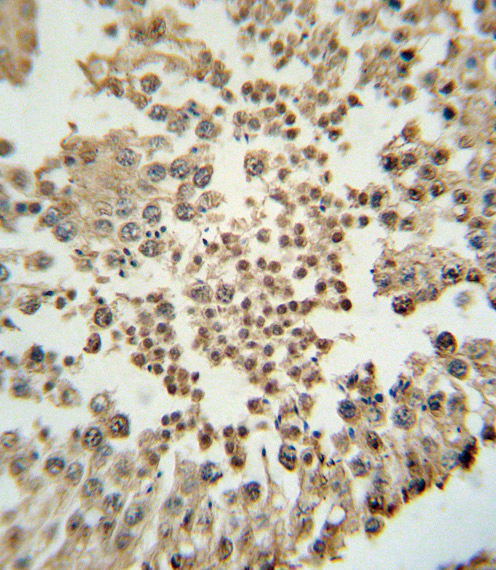 Paraformaldehyde-fixed, paraffin embedded Human testis; Antigen retrieval by boiling in sodium citrate buffer (pH6.0) for 15min; Block endogenous peroxidase by 3% hydrogen peroxide for 20 minutes; Blocking buffer (normal goat serum) at 37°C for 30min; Antibody incubation with EZH2 Monoclonal Antibody, Unconjugated (bsm-51468M) at 1:200 overnight at 4°C, DAB staining.