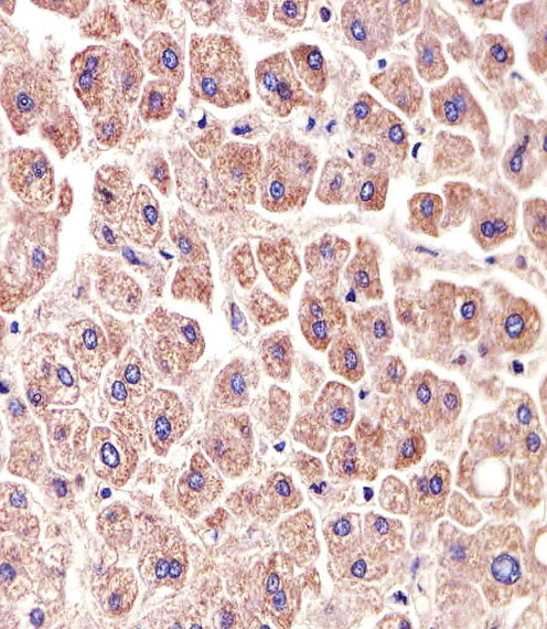 Paraformaldehyde-fixed, paraffin embedded Human liver; Antigen retrieval by boiling in sodium citrate buffer (pH6.0) for 15min; Block endogenous peroxidase by 3% hydrogen peroxide for 20 minutes; Blocking buffer (normal goat serum) at 37°C for 30min; Antibody incubation with ALDH6A1 Monoclonal Antibody, Unconjugated (bsm-51469M) at 1:25 overnight at 4°C, DAB staining.
