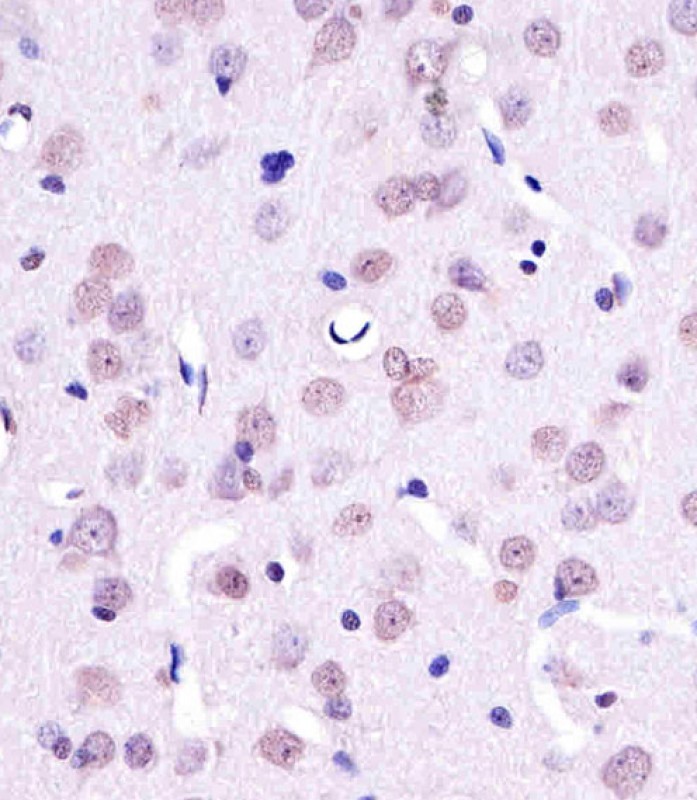 Paraformaldehyde-fixed, paraffin embedded Rat brain; Antigen retrieval by boiling in sodium citrate buffer (pH6.0) for 15min; Block endogenous peroxidase by 3% hydrogen peroxide for 20 minutes; Blocking buffer (normal goat serum) at 37°C for 30min; Antibody incubation with YY1(Nuclear Loading Control) Monoclonal Antibody, Unconjugated (bsm-51566M) at 1:25 overnight at 4°C, DAB staining.