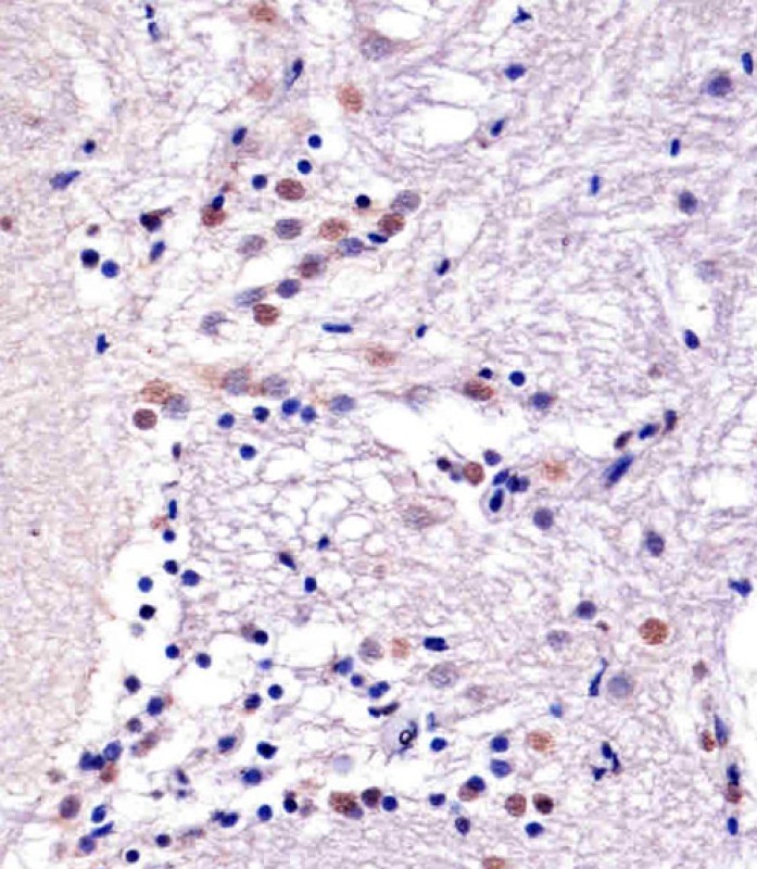 Paraformaldehyde-fixed, paraffin embedded Zebrafish brain; Antigen retrieval by boiling in sodium citrate buffer (pH6.0) for 15min; Block endogenous peroxidase by 3% hydrogen peroxide for 20 minutes; Blocking buffer (normal goat serum) at 37°C for 30min; Antibody incubation with YY1(Nuclear Loading Control) Monoclonal Antibody, Unconjugated (bsm-51566M) at 1:25 overnight at 4°C, DAB staining.