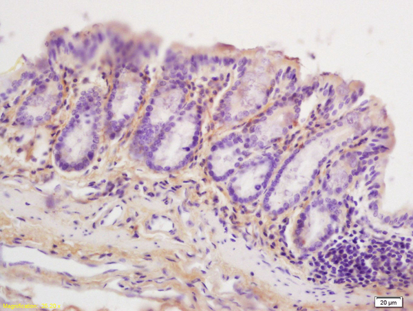 Formalin-fixed and paraffin embedded mouse small intestine tissue labeled with Anti-ERG25 Polyclonal Antibody, Unconjugated (bs-2947R) at 1:200 followed by conjugation to the secondary antibody and DAB staining