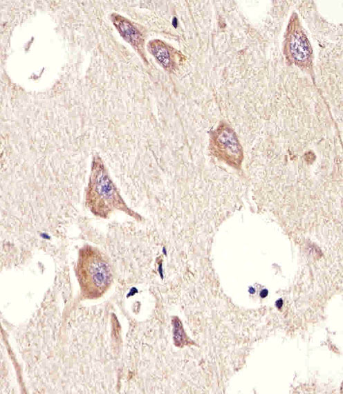 Paraformaldehyde-fixed, paraffin embedded Human brain; Antigen retrieval by boiling in sodium citrate buffer (pH6.0) for 15min; Block endogenous peroxidase by 3% hydrogen peroxide for 20 minutes; Blocking buffer (normal goat serum) at 37°C for 30min; Antibody incubation with CHRM2 Monoclonal Antibody, Unconjugated (bsm-51598M) at 1:25 overnight at 4°C, DAB staining.