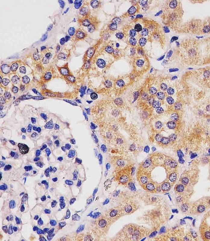 Paraformaldehyde-fixed, paraffin embedded Human kidney; Antigen retrieval by boiling in sodium citrate buffer (pH6.0) for 15min; Block endogenous peroxidase by 3% hydrogen peroxide for 20 minutes; Blocking buffer (normal goat serum) at 37°C for 30min; Antibody incubation with GLS2 Monoclonal Antibody, Unconjugated (bsm-51645M) at 1:25 overnight at 4°C, DAB staining.