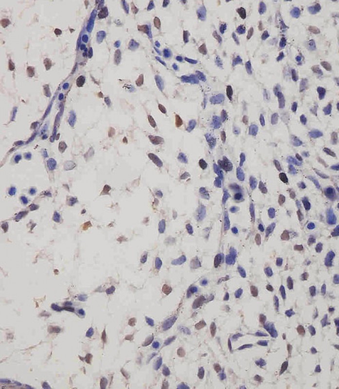 Paraformaldehyde-fixed, paraffin embedded Mouse embryo; Antigen retrieval by boiling in sodium citrate buffer (pH6.0) for 15min; Block endogenous peroxidase by 3% hydrogen peroxide for 20 minutes; Blocking buffer (normal goat serum) at 37°C for 30min; Antibody incubation with SUFU Monoclonal Antibody, Unconjugated (bsm-51651M) at 1:25 overnight at 4°C, DAB staining. Paraformaldehyde-fixed, paraffin embedded Mouse embryo; Antigen retrieval by boiling in sodium citrate buffer (pH6.0) for 15min; Block endogenous peroxidase by 3% hydrogen peroxide for 20 minutes; Blocking buffer (normal goat serum) at 37°C for 30min; Antibody incubation with SUFU Monoclonal Antibody, Unconjugated (bsm-51651M) at 1:25 overnight at 4°C, DAB staining.