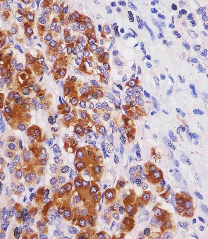 Paraformaldehyde-fixed, paraffin embedded Human pancreas; Antigen retrieval by boiling in sodium citrate buffer (pH6.0) for 15min; Block endogenous peroxidase by 3% hydrogen peroxide for 20 minutes; Blocking buffer (normal goat serum) at 37°C for 30min; Antibody incubation with REG3G Monoclonal Antibody, Unconjugated (bsm-51653M) at 1:25 overnight at 4°C, DAB staining.
