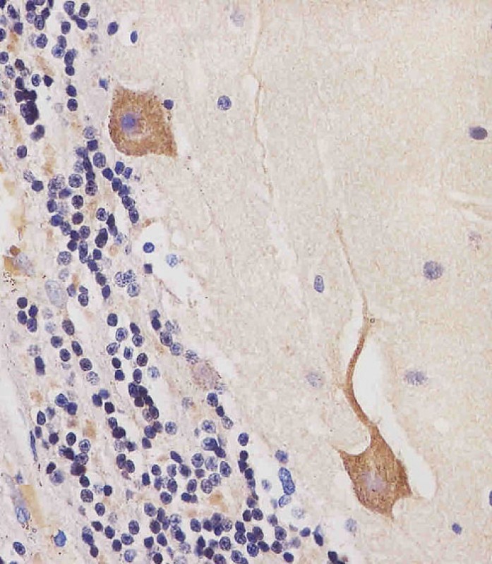 Paraformaldehyde-fixed, paraffin embedded Human cerebellum; Antigen retrieval by boiling in sodium citrate buffer (pH6.0) for 15min; Block endogenous peroxidase by 3% hydrogen peroxide for 20 minutes; Blocking buffer (normal goat serum) at 37°C for 30min; Antibody incubation with CAMK2 beta Monoclonal Antibody, Unconjugated (bsm-51658M) at 1:25 overnight at 4°C, DAB staining.