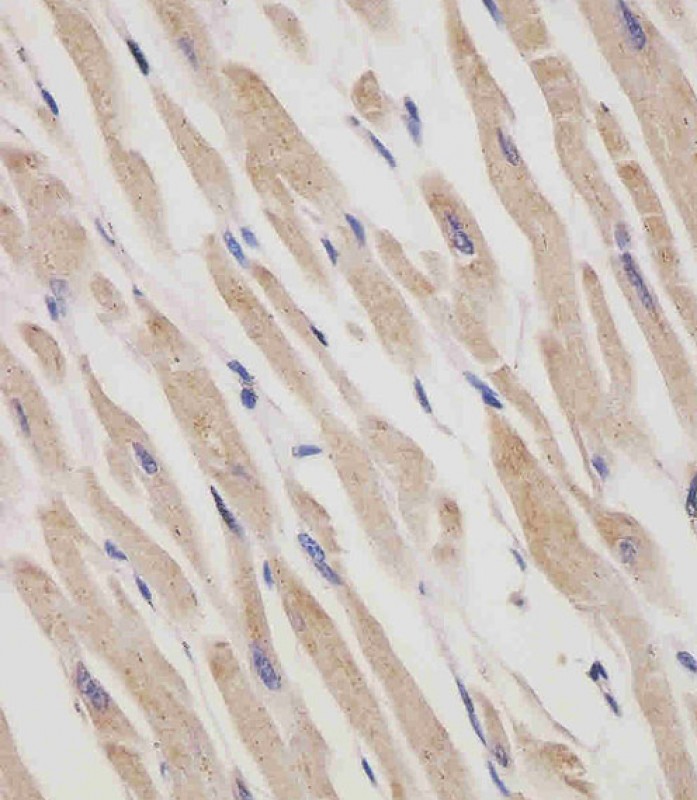 Paraformaldehyde-fixed, paraffin embedded Human heart; Antigen retrieval by boiling in sodium citrate buffer (pH6.0) for 15min; Block endogenous peroxidase by 3% hydrogen peroxide for 20 minutes; Blocking buffer (normal goat serum) at 37°C for 30min; Antibody incubation with RANBP9 Monoclonal Antibody, Unconjugated (bsm-51664M) at 1:25 overnight at 4°C, DAB staining.