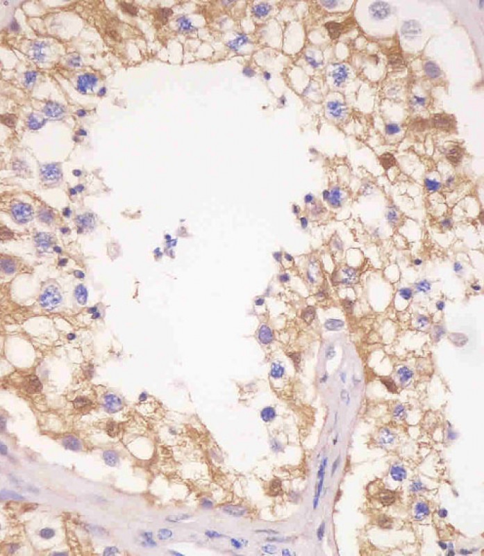 Paraformaldehyde-fixed, paraffin embedded Human testis; Antigen retrieval by boiling in sodium citrate buffer (pH6.0) for 15min; Block endogenous peroxidase by 3% hydrogen peroxide for 20 minutes; Blocking buffer (normal goat serum) at 37°C for 30min; Antibody incubation with PDXK Monoclonal Antibody, Unconjugated (bsm-51665M) at 1:25 overnight at 4°C, DAB staining.