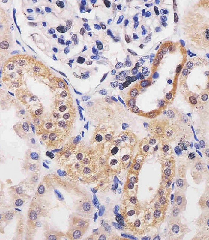 Paraformaldehyde-fixed, paraffin embedded Human kidney; Antigen retrieval by boiling in sodium citrate buffer (pH6.0) for 15min; Block endogenous peroxidase by 3% hydrogen peroxide for 20 minutes; Blocking buffer (normal goat serum) at 37°C for 30min; Antibody incubation with ADK Monoclonal Antibody, Unconjugated (bsm-51668M) at 1:25 overnight at 4°C, DAB staining.