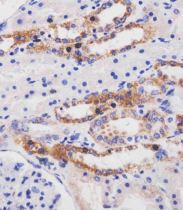 Paraformaldehyde-fixed, paraffin embedded Human kidney; Antigen retrieval by boiling in sodium citrate buffer (pH6.0) for 15min; Block endogenous peroxidase by 3% hydrogen peroxide for 20 minutes; Blocking buffer (normal goat serum) at 37°C for 30min; Antibody incubation with ME2 Monoclonal Antibody, Unconjugated (bsm-51670M) at 1:25 overnight at 4°C, DAB staining.
