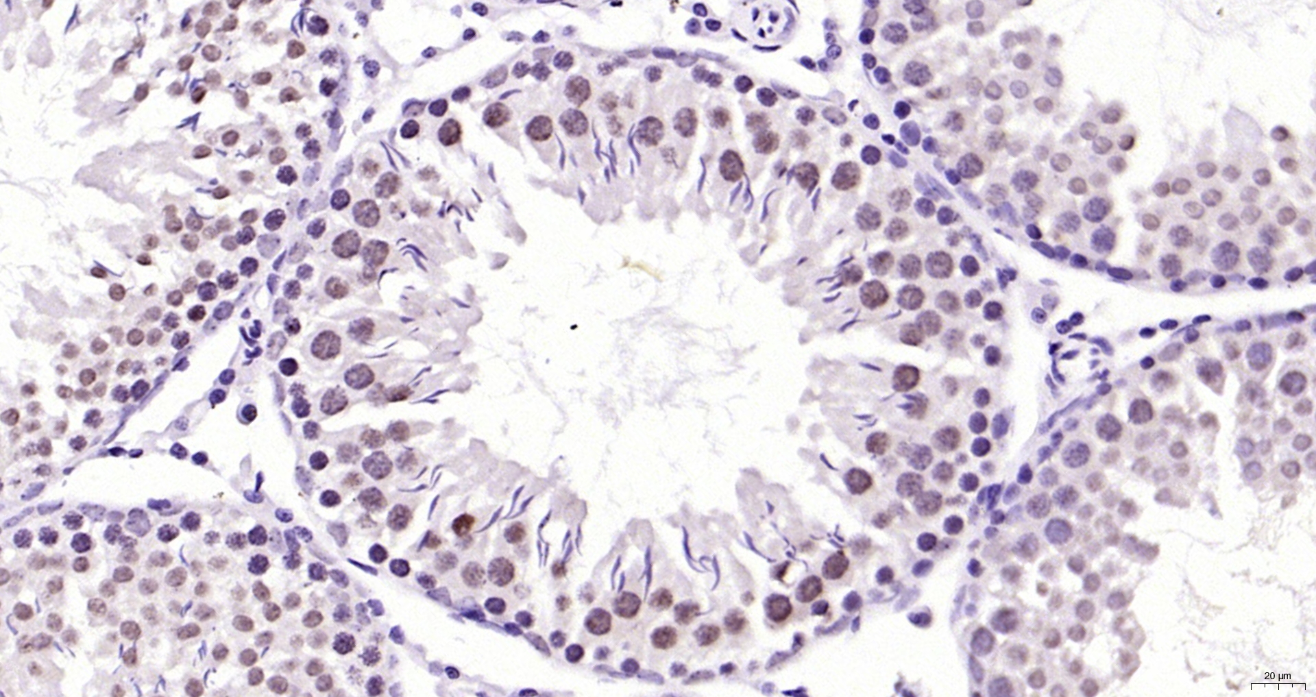 Paraformaldehyde-fixed, paraffin embedded Rat testis; Antigen retrieval by boiling in sodium citrate buffer (pH6.0) for 15min; Block endogenous peroxidase by 3% hydrogen peroxide for 20 minutes; Blocking buffer (normal goat serum) at 37°C for 30min; Antibody incubation with CAMK4 (3F11) Monoclonal Antibody, Unconjugated (bsm-54336R) at 1:200 overnight at 4°C, DAB staining.