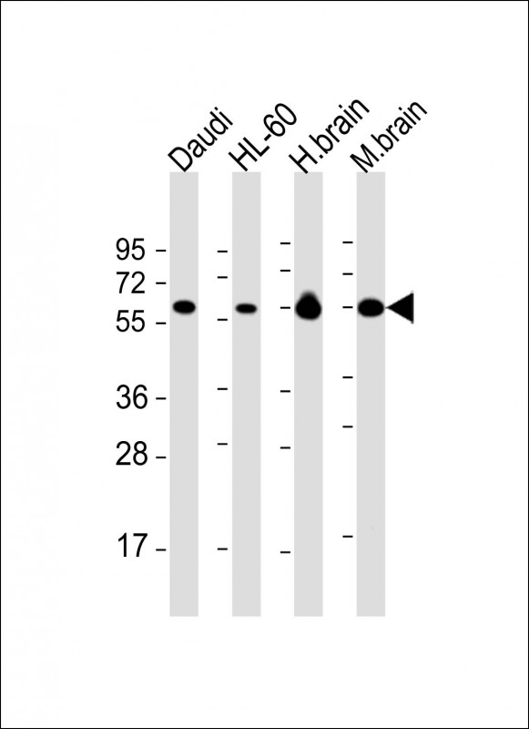 Lane 1: Daudi cell lysates; Lane 2: HL-60 cell lysates; Lane 3: Human brain tissue lysates; Lane 4: Mouse brain tissue lysates probed with PACSIN2 Monoclonal Antibody, Unconjugated (bsm-51639M) at 1:2000 dilution and 4°C overnight incubation. Followed by conjugated secondary antibody incubation at 1:20000 for 60 min at 37˚C.