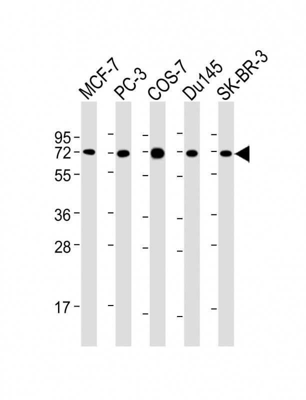 Lane 1: MCF-7 cell lysates; Lane 2: PC-3 cell lysates; Lane 3: COS-7 cell lysates; Lane 4: Du145 cell lysates; Lane 5: SK-BR-3 cell lysates probed with USP2 Monoclonal Antibody, Unconjugated (bsm-51636M) at 1:2000 dilution and 4°C overnight incubation. Lysates/proteins at 20 µg per lane. Followed by conjugated secondary antibody incubation at 1:10000 for 60 min at 37˚C.