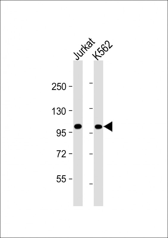 Lane 1: Jurkat cell lysates; Lane 2: K562 cell lysates probed with PRDM16 Monoclonal Antibody, Unconjugated (bsm-51634M) at 1:4000 dilution and 4°C overnight incubation. Followed by conjugated secondary antibody incubation at 1:20000 for 60 min at 37˚C.