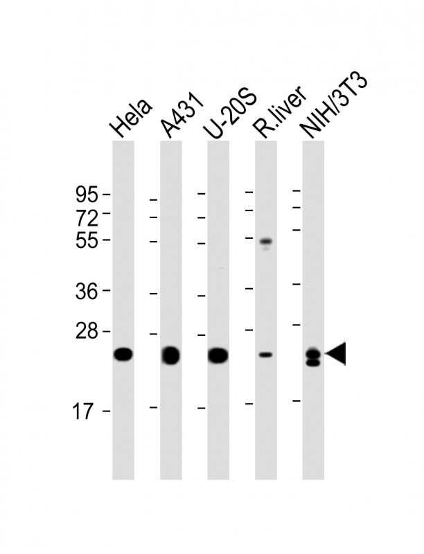 Lane 1: Hela cell lysates; Lane 2: A431 cell lysates; Lane 3: U-20S cell lysates; Lane 4: Rat liver tissue lysates; Lane 5: NIH/3T3 cell lysates probed with RAB1B Monoclonal Antibody, Unconjugated (bsm-51615M) at 1:4000 dilution and 4°C overnight incubation. Followed by conjugated secondary antibody incubation at 1:20000 for 60 min at 37˚C.