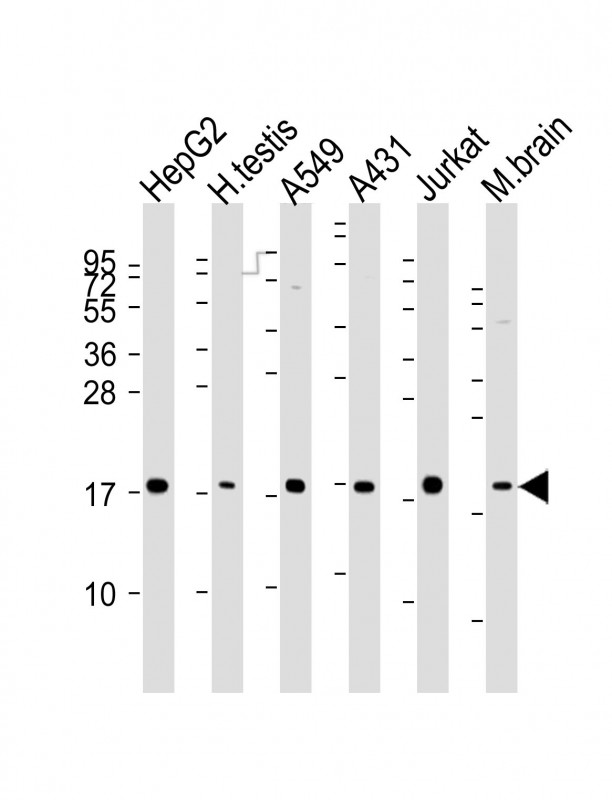 Lane 1: HepG2 cell lysates; Lane 2: Human testis tissue lysates; Lane 3: A549 cell lysates; Lane 4: A431 cell lysates; Lane 5: Jurkat cell lysates; Lane 6: Mouse brain tissue lysates probed with EEF1E1 Monoclonal Antibody, Unconjugated (bsm-51605M) at 1:2000~4000 dilution and 4°C overnight incubation. Followed by conjugated secondary antibody incubation at 1:20000 for 60 min at 37˚C. Lane 1: HepG2 cell lysates; Lane 2: Human testis tissue lysates; Lane 3: A549 cell lysates; Lane 4: A431 cell lysates; Lane 5: Jurkat cell lysates; Lane 6: Mouse brain tissue lysates probed with EEF1E1 Monoclonal Antibody, Unconjugated (bsm-51605M) at 1:2000~4000 dilution and 4°C overnight incubation. Followed by conjugated secondary antibody incubation at 1:20000 for 60 min at 37˚C.