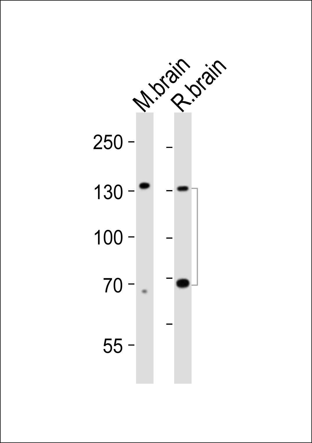 Lane 1: Mouse brain tissue lysates; Lane 2: Rat brain tissue lysates probed with TrkC Monoclonal Antibody, Unconjugated (bsm-51599M) at 1:1000 dilution and 4°C overnight incubation. Followed by conjugated secondary antibody incubation at 1:20000 for 60 min at 37˚C.