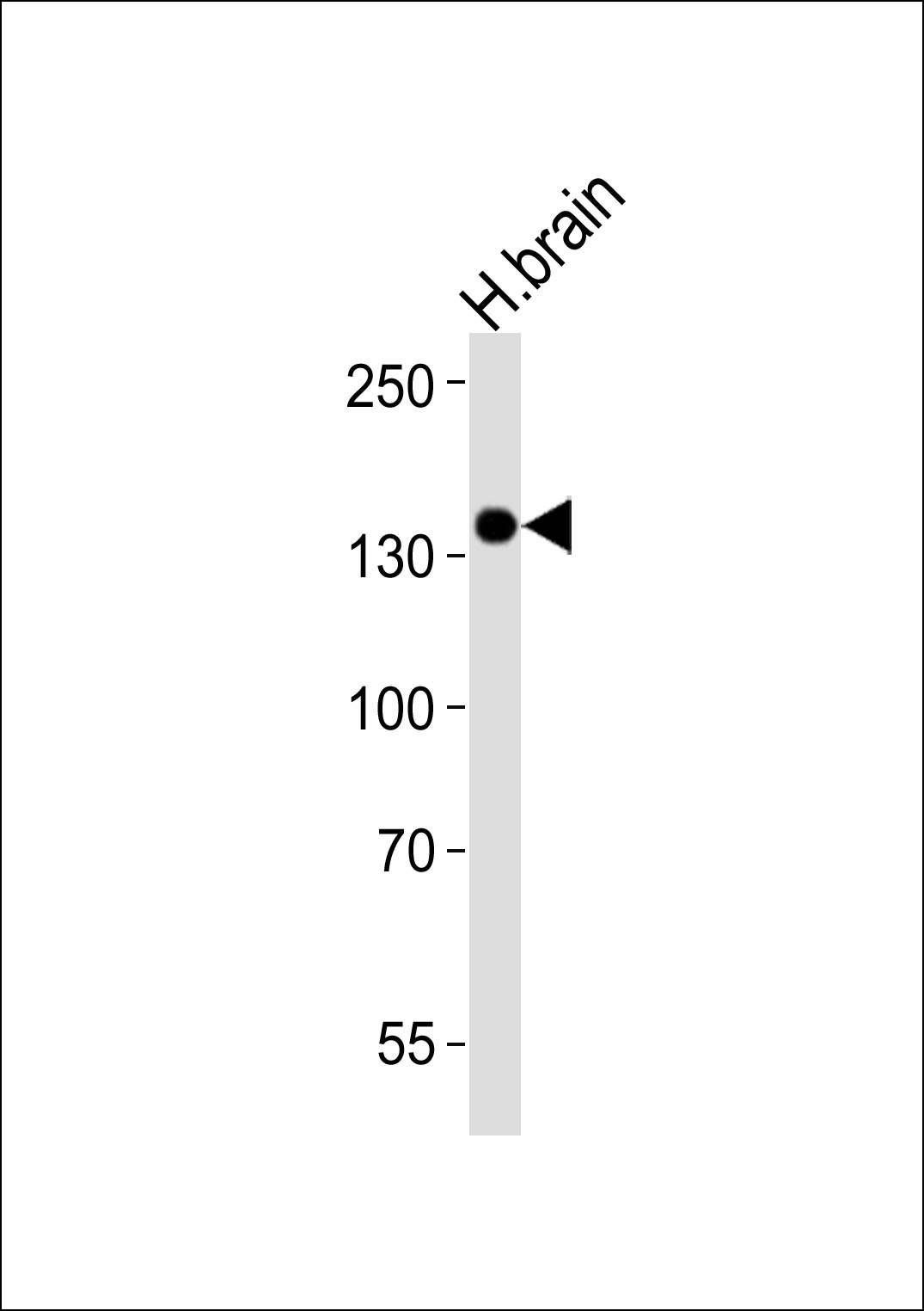 Lane 1: Human brain tissue lysates probed with TrkC Monoclonal Antibody, Unconjugated (bsm-51599M) at 1:1000 dilution and 4°C overnight incubation. Followed by conjugated secondary antibody incubation at 1:20000 for 60 min at 37˚C.