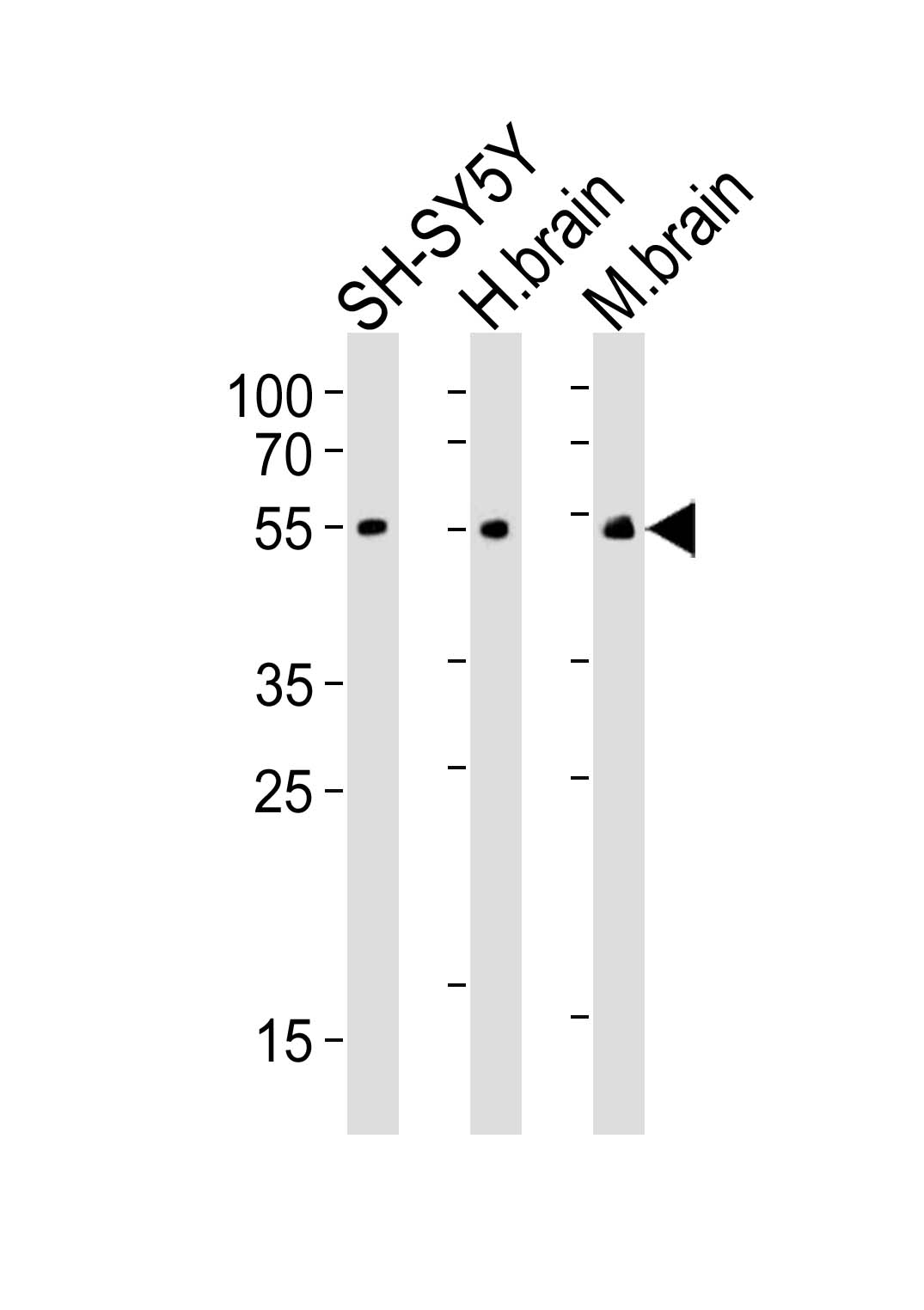 Lane 1: SH-SY5Y cell lysates; Lane 2: Human brain tissue lysates; Lane 3: Mouse brain tissue lysates probed with CHRM2 Monoclonal Antibody, Unconjugated (bsm-51598M) at 1:1000 dilution and 4°C overnight incubation. Followed by conjugated secondary antibody incubation at 1:20000 for 60 min at 37˚C.