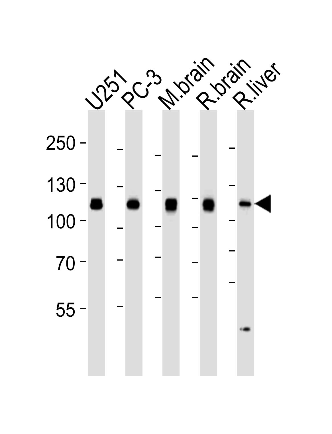 Lane 1: U251 cell lysates; Lane 2: PC-3 cell lysates; Lane 3: Mouse brain tissue lysates; Lane 4: Rat brain tissue lysates; Lane 5: Rat liver tissue lysates probed with USP5 Monoclonal Antibody, Unconjugated (bsm-51588M) at 1:1000 dilution and 4°C overnight incubation. Followed by conjugated secondary antibody incubation at 1:20000 for 60 min at 37˚C. Lane 1: U251 cell lysates; Lane 2: PC-3 cell lysates; Lane 3: Mouse brain tissue lysates; Lane 4: Rat brain tissue lysates; Lane 5: Rat liver tissue lysates probed with USP5 Monoclonal Antibody, Unconjugated (bsm-51588M) at 1:1000 dilution and 4°C overnight incubation. Followed by conjugated secondary antibody incubation at 1:20000 for 60 min at 37˚C.