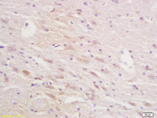 Formalin-fixed and paraffin embedded rat brain tissue labeled with Anti-Squalene EpoxidasePolyclonal Antibody, Unconjugated (bs-4218R) at 1:200 followed by conjugation to the secondary antibody and DAB staining