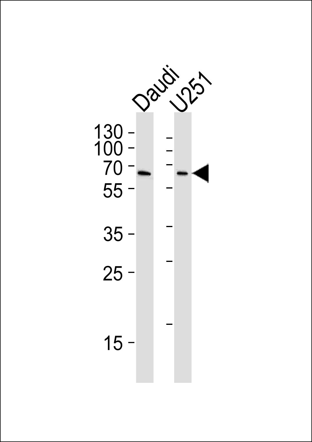 Lane 1: Daudi cell lysates; Lane 2: U251 cell lysates probed with YY1 Monoclonal Antibody, Unconjugated (bsm-51566M) at 1:1000 dilution and 4°C overnight incubation. Followed by conjugated secondary antibody incubation at 1:20000 for 60 min at 37˚C.