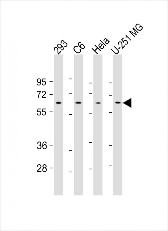 Lane 1: 293 cell lysates; Lane 2:C6 cell lysates; Lane 3: Hela cell lysates; Lane 4: U-251MG cell lysates probed with YY1 Monoclonal Antibody, Unconjugated (bsm-51566M) at 1:1000 dilution and 4°C overnight incubation. Followed by conjugated secondary antibody incubation at 1:20000 for 60 min at 37˚C.