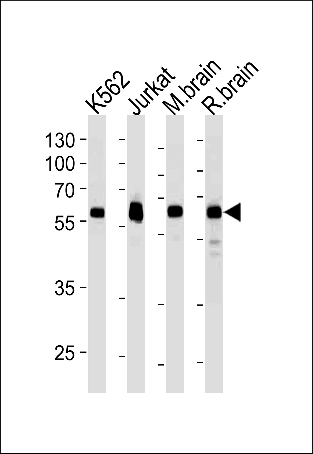 Lane 1: K562 cell lysates; Lane 2: Jurkat cell lysates; Lane 3: Mouse brain tissue lysates; Lane 4: Rat brain tissue lysates probed with USP14 Monoclonal Antibody, Unconjugated (bsm-51562M) at 1:1000 dilution and 4°C overnight incubation. Followed by conjugated secondary antibody incubation at 1:20000 for 60 min at 37˚C.