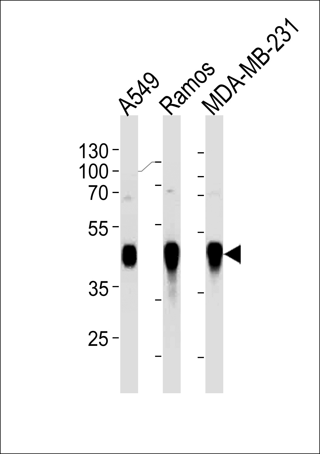 Lane 1: A549 cell lysates; Lane 2: Ramos cell lysates; Lane 3: MDA-MB-231 cell lysates probed with HLA-G Monoclonal Antibody, Unconjugated (bsm-51559M) at 1:1000 dilution and 4°C overnight incubation. Followed by conjugated secondary antibody incubation at 1:20000 for 60 min at 37˚C.