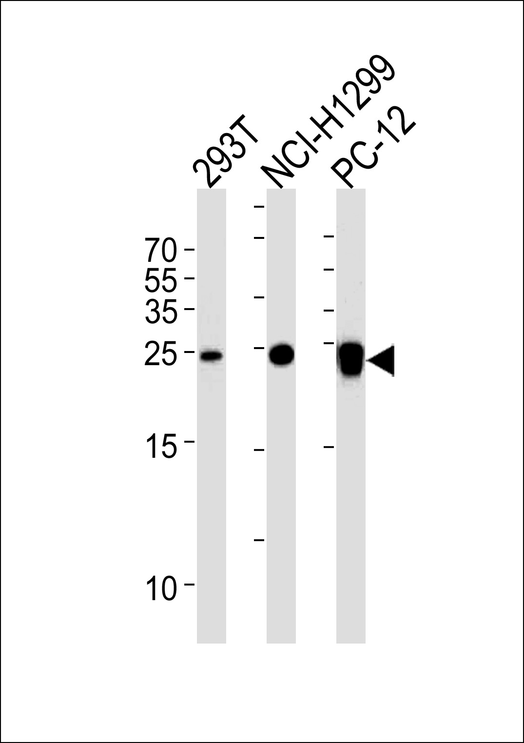 Lane 1: 293T cell lysates; Lane 2: NCI-H1299 cell lysates; Lane 3: PC-12 cell lysates probed with UCHL1\/PGP9.5 Monoclonal Antibody, Unconjugated (bsm-51558M) at 1:1000 dilution and 4\u00b0C overnight incubation. Followed by conjugated secondary antibody incubation at 1:20000 for 60 min at 37˚C.