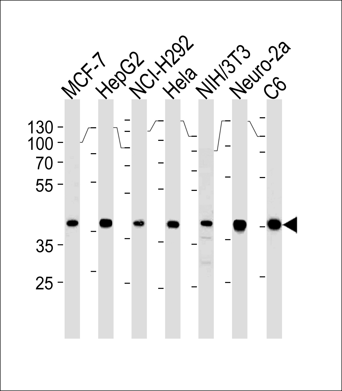 Lane 1: MCF-7 cell lysates; Lane 2: HepG2 cell lysates; Lane 3: NCI-H292 cell lysates; Lane 4: Hela cell lysates; Lane 5: NIH/3T3 cell lysates; Lane 6: Neuro-2a cell lysates; Lane 7: C6 cell lysates probed with Erk2 Monoclonal Antibody, Unconjugated (bsm-51555M) at 1:1000 dilution and 4°C overnight incubation. Followed by conjugated secondary antibody incubation at 1:20000 for 60 min at 37˚C.