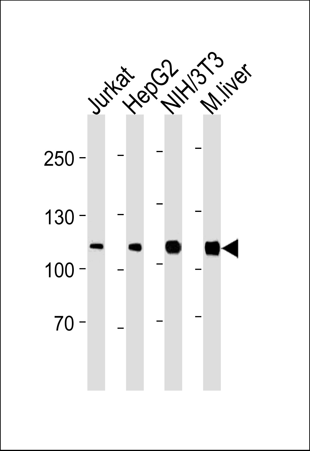 Lane 1: Jurkat cell lysates; Lane 2: HepG2 cell lysates; Lane 3: NIH/3T3 cell lysates; Lane 4: Mouse Liver tissue lysates probed with Glucocorticoid receptor Monoclonal Antibody, Unconjugated (bsm-51554M) at 1:1000 dilution and 4°C overnight incubation. Followed by conjugated secondary antibody incubation at 1:20000 for 60 min at 37˚C.